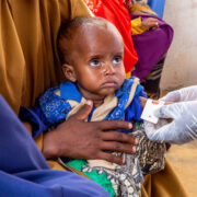 7-month-old child receives treated for malnutrition