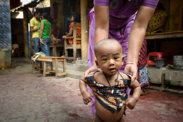 Baby Parul, 8 months old, lives in a brothel with her mother, who works as a sex worker.