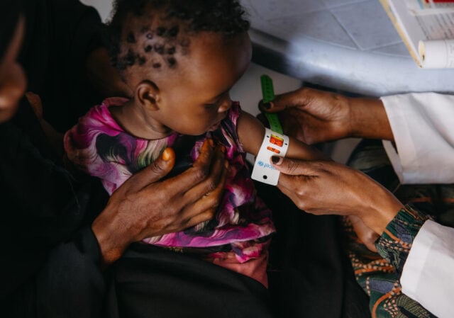 A healthcare worker measures a child’s arm for malnutrition using a mid-upper arm circumference (MUAC) tape, showing red for severe acute malnutrition.