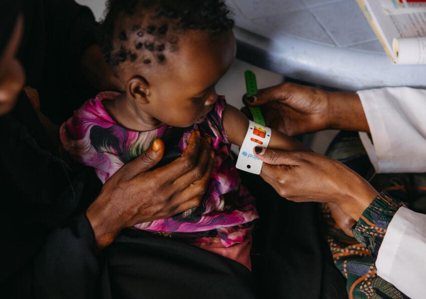 A healthcare worker measures a child’s arm for malnutrition using a mid-upper arm circumference (MUAC) tape, showing red for severe acute malnutrition.