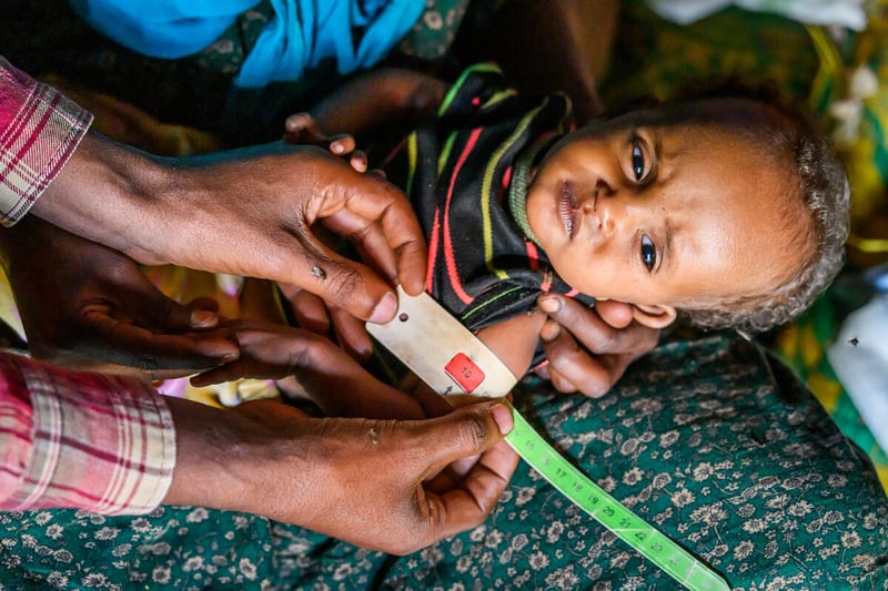 A mother’s hand cradles her baby’s head while two hands wrap a measuring tape around a frail child’s arm. The child looks sad.