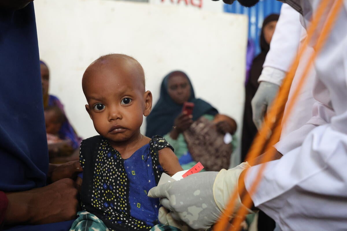 A health care worker measures a child’s upper arm with a color-coded tape to screen for malnutrition, with the measurement indicating severe acute malnutrition.